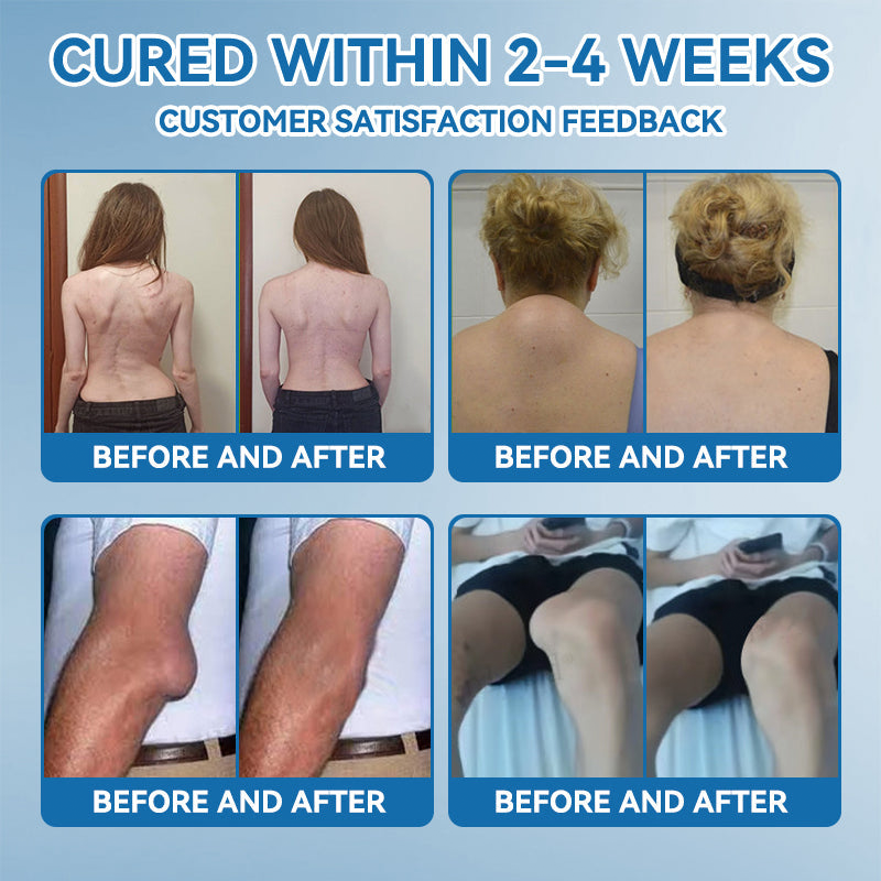 Official store 👩‍⚕️🥇| NATRAVOR® BPC-157 Joint Healing Cream🏃‍Treats Arthritis,Neuropathy,Rheumatism,Sports Injuries&More👍