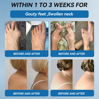 Official store 👩‍⚕️🥇| NATRAVOR® BPC-157 Joint Healing Cream🏃‍Treats Arthritis,Neuropathy,Rheumatism,Sports Injuries&More👍