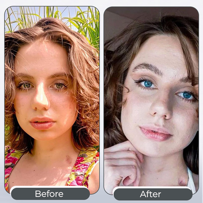 Trendyeed® Pro Formula Eye Drops: Advanced Color Transformation & Eye Nourishment