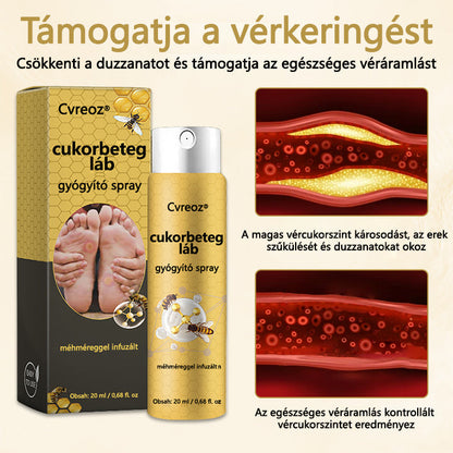 [Official Brand Store]💎Timilk® Diabetic Foot Repair Spray - with Bee Venom